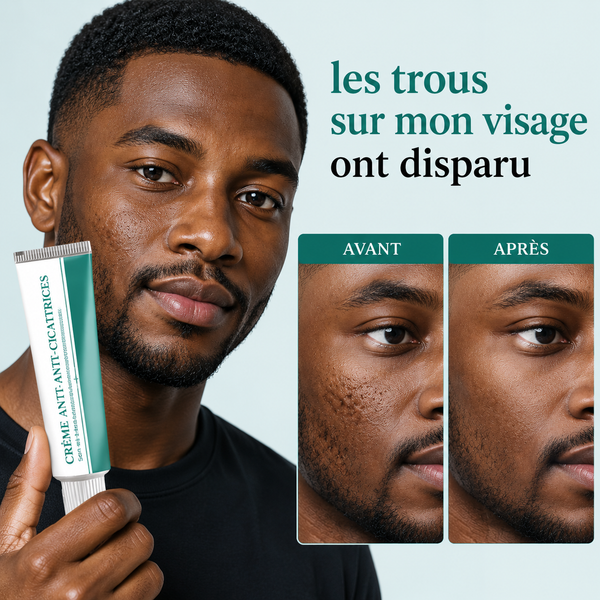 Crème Anti-Cicatrices & Acné-CG