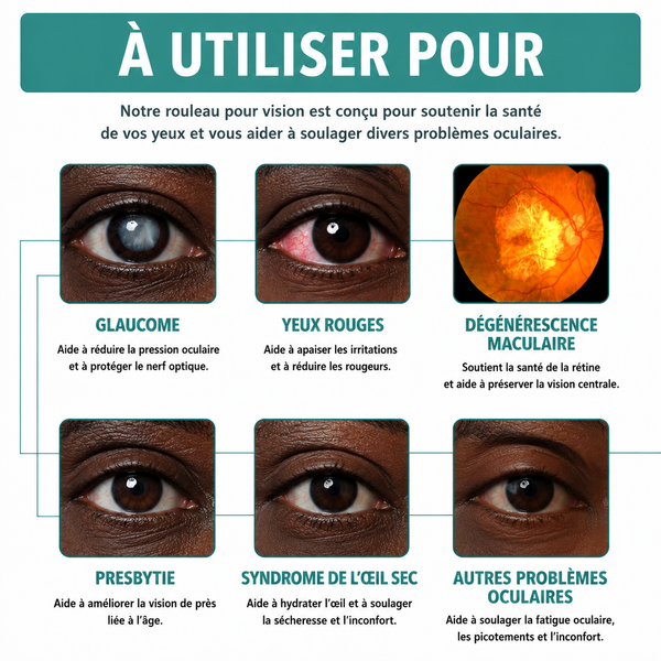 Rouleur pour Vision – Eelhoe ML