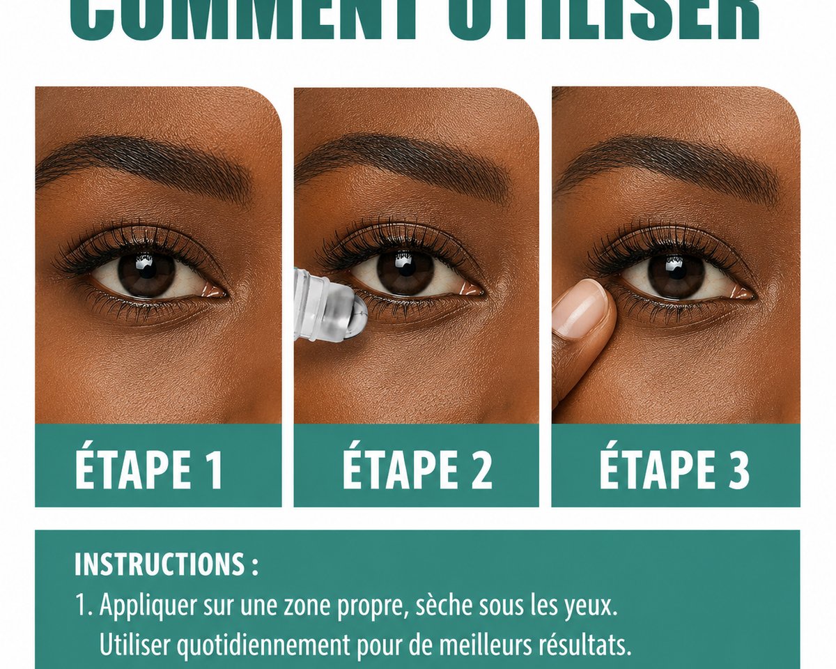 Rouleur pour Vision – Eelhoe TG