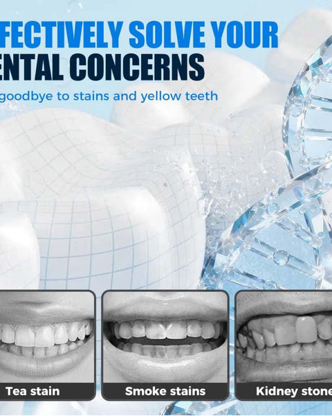 Tiras branqueadoras profissionais para dentes QimGo