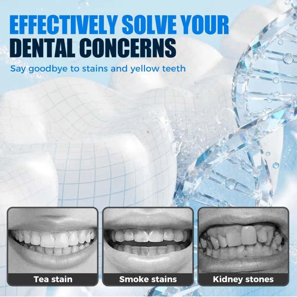 Tiras branqueadoras profissionais para dentes QimGo