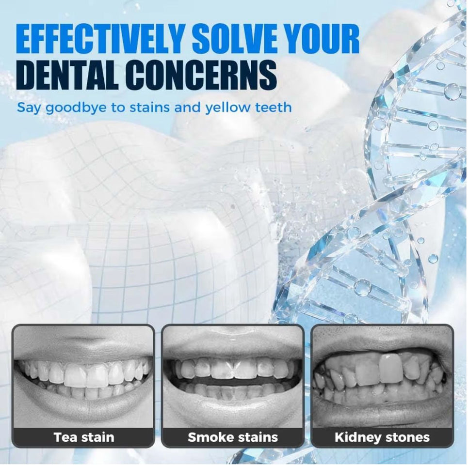 Tiras branqueadoras profissionais para dentes QimGo